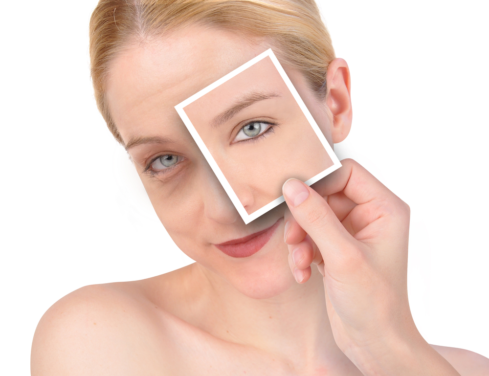 remède naturel pour atténuer les cernes