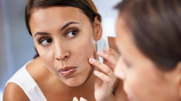 Comment venir à bout des boutons disgracieux ou de l’acné